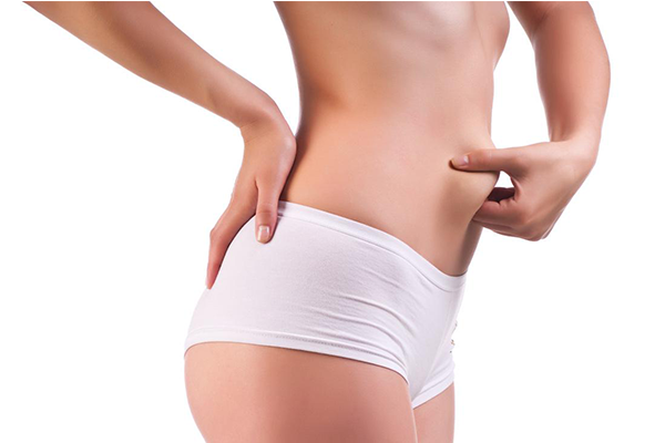 liposuction